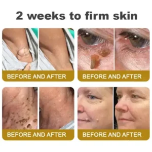 Botox Bee Venom Skin Treatment Cream - Image 4