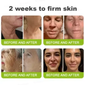 Botox & Vita-A Retinol Shot Tightening and Wrinkle-Reducing Cream - Image 8