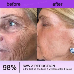 NAD+ Retinol Firming & Lifting Cream - Image 6