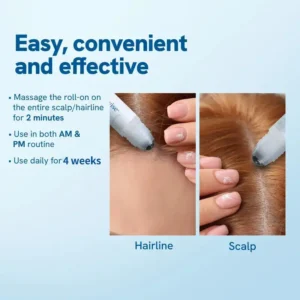 Professional Anti-Hair Loss Roll-On - Image 3