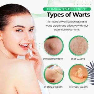 SmoothSkin Wart Eliminator Soap - Image 3