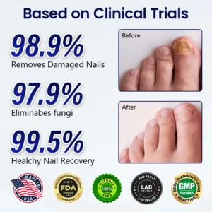Anti-Fungal Nail Repair Patch - Image 2