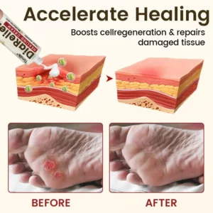 DiaRelief Healing Cream - Image 4