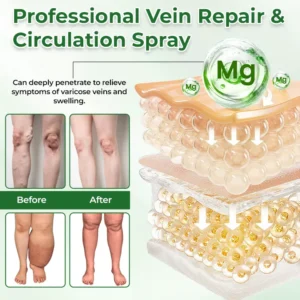 VeinFlex Magnesium Relief Spray - Image 3