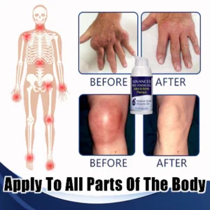 Advanced Joint & Bone Therapy Bee Venom Gel - Image 2