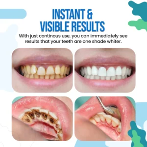 Instant Teeth Whitening Paint - Image 7
