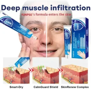 Mole and Wart Removal Cream - Image 4