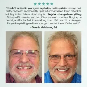 – Medical Full Denture with Strong Suctiond - Image 20