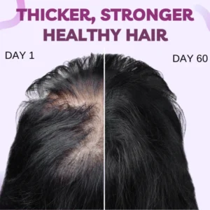 Hair Growth Minoxidil Foam - Image 4