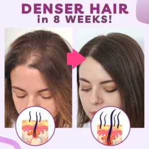 Hair Growth Minoxidil Foam - Image 6