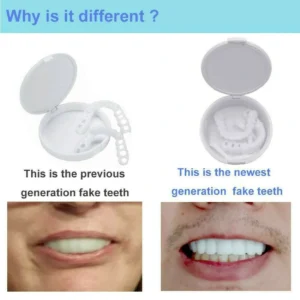 New Plus Protection Snap-On Dentures - Image 6