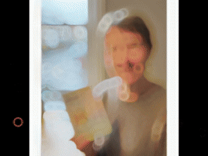 Fat Activating Microneedle Patches - Image 8