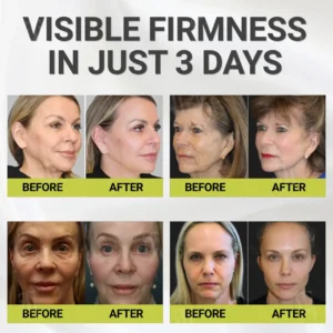 Botox & Vita-A Retinol Shot Wrinkle - Lift Tightening Cream - Image 4