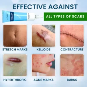 Silicone Scar Gel - Image 2