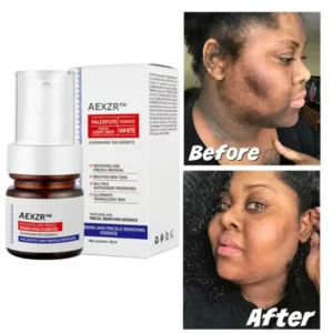 Vitamin C Whitening Freckles Face Cream Remove Melasma Dark Spots Lighten Melanin - Image 11