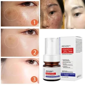 Vitamin C Whitening Freckles Face Cream Remove Melasma Dark Spots Lighten Melanin - Image 15