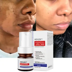 Vitamin C Whitening Freckles Face Cream Remove Melasma Dark Spots Lighten Melanin - Image 8