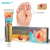 Bedsore Treatment Cream