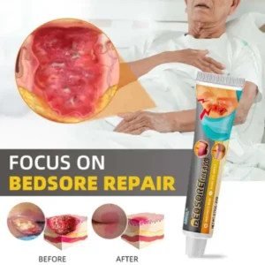 Bedsore Treatment Cream - Image 3