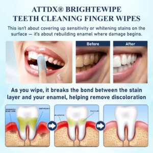BrighteWipe Teeth Cleaning Finger Wipes - Image 3