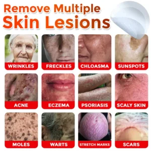MicroNeedle Botanic Skin Tag Removal Patch - Image 2