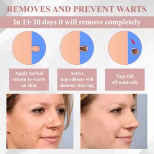 Tag & Blemish Peel-Off Gel Wrapping Mask - Image 10