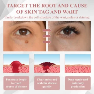 Tag & Blemish Peel-Off Gel Wrapping Mask - Image 11
