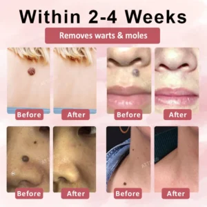 Tag & Blemish Peel-Off Gel Wrapping Mask - Image 4