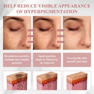 Tag & Blemish Peel-Off Gel Wrapping Mask - Image 8