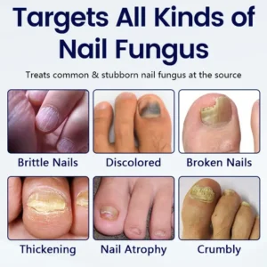 Anti-Fungal Nail Repair Patch - Image 3