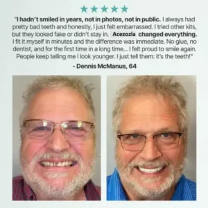 Custom-Fit Fully Functional Dentures - Image 11