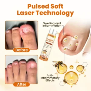 FungiBee Advanced Nail Repair Spray - Image 7