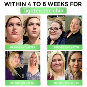 Moringa × Berberine × AMPK 8-Benefit Slimming & Metabolic Nano Microneedle Patch - Image 3