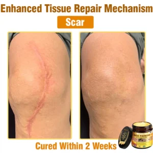 𝐁𝐞𝐞 𝐏𝐨𝐢𝐬𝐨𝐧 𝐀𝐥𝐥-𝐢𝐧-𝐎𝐧𝐞 𝐂𝐫𝐞𝐚𝐦–🌸 Anti-aging,Hydrating, Skin Repair, Even Tone, Acne and Dark Spot Treatment, Wart and Mole Removal, Psoriasis Relief - Image 12