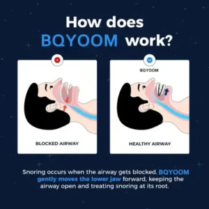 BQYOOM Adjustable Anti-Snoring Mouthpiece - Image 3