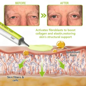 BOTOX & VITA A RETINOL SHOT Wrinkle Lift Tightening Cream - Image 62