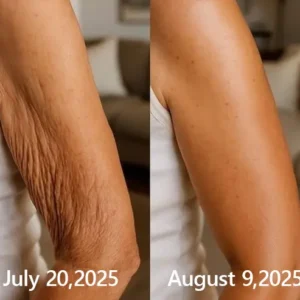 BOTOX & VITA A RETINOL SHOT Wrinkle Lift Tightening Cream - Image 53