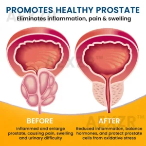 Prostate Care Patch - Image 5
