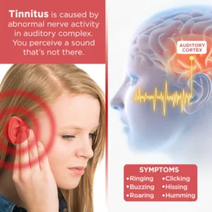Audiozen Tinnitus Relief Ear Plugs - Image 4