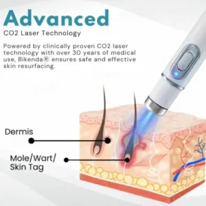 Professional Non-Invasive Mole and Wart Removal Laser Pen - Image 6