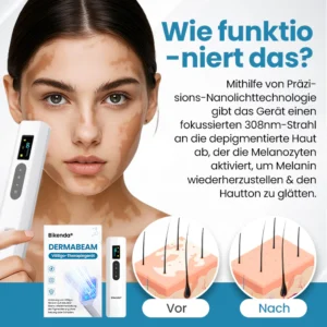 DermaBeam Vitiligo-Therapiegerät - Image 2