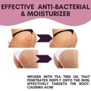 Butt Treatment Cream - Image 3