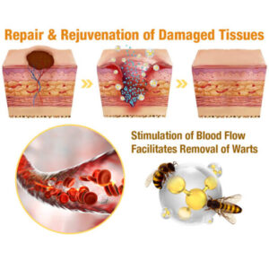 Bee Venom Mole and Wart Treatment Cream - Image 11