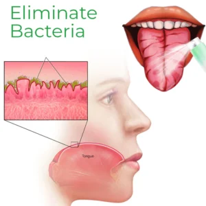 Canada Fissured Tongue Relief Spray - Image 3