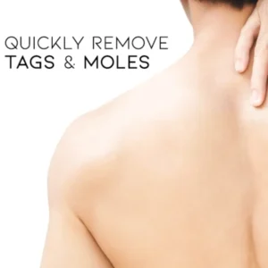 Bee Venom Mole and Wart Treatment Cream - LIMITED-TIME OFFER - Image 8
