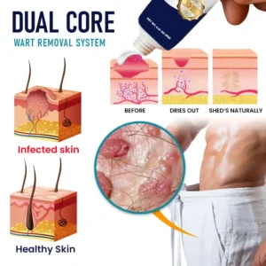 Genital Warts Remover Cream - Image 3