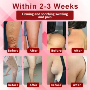 EdemaCare Lymphatic Drainage Massage Cream - Image 2