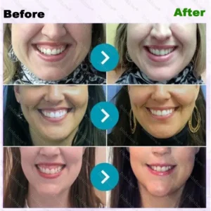 🐝 ApiCore BeeVenom Vital Repair Toothpaste - Image 4
