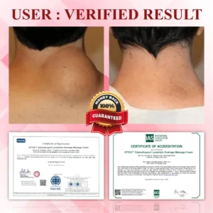 VenoLymph Massage Therapy Cream - Image 4