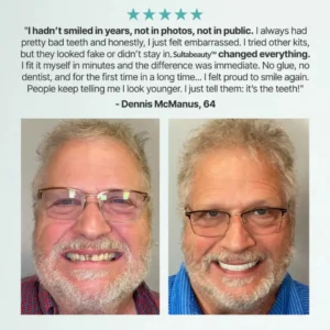 Custom-Fit Full Functional Dentures Make you more confident - Image 10